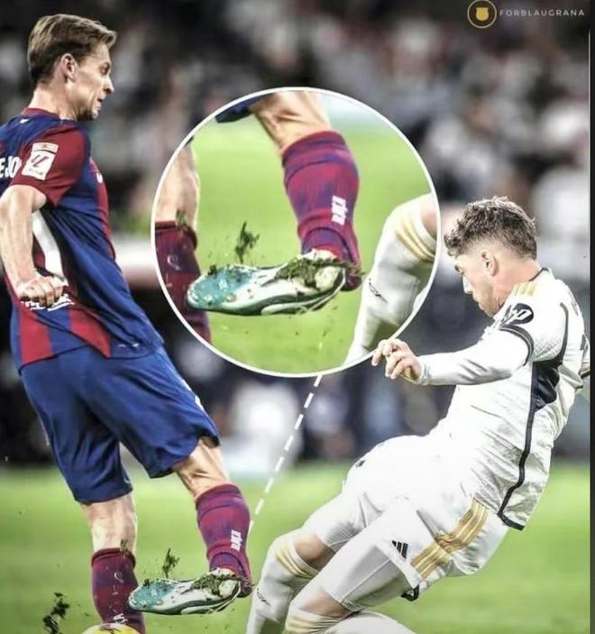 足球运动员受伤，需紧急处理伤痛